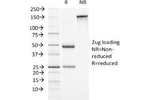 SDS-PAGE Analysis Purified Alpha-1-Antichymotrypsin Monoclonal Antibody (AACT/1451)Confirmation of Integrity and Purity of Antibody.