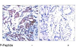 Image no. 1 for anti-Jun Proto-Oncogene (JUN) (pSer73) antibody (ABIN196613) (C-JUN anticorps  (pSer73))
