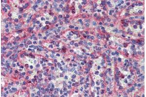 Spleen, Human: Formalin-Fixed, Paraffin-Embedded (FFPE)