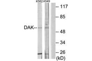 Western blot analysis of extracts from K562/A549 cells, using DAK Antibody. (DAK anticorps  (AA 91-140))
