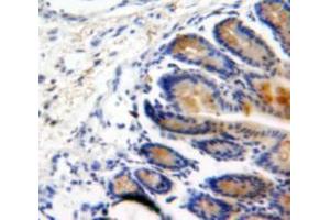 Used in DAB staining on fromalin fixed paraffin-embedded Intestine tissue (BMP2 anticorps  (AA 24-396))