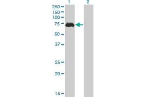 Western Blot analysis of MAP3K7 expression in transfected 293T cell line by MAP3K7 monoclonal antibody (M02), clone 2E10.