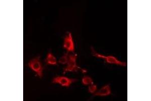 ABIN6274982 staining Hela cells by IF/ICC. (CDC42EP5 anticorps  (N-Term))
