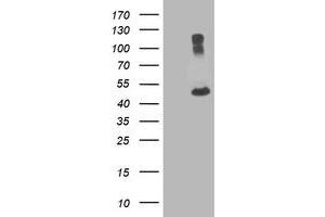 Western Blotting (WB) image for anti-Tubulin, alpha 8 (TUBA8) antibody (ABIN1501562) (TUBA8 anticorps)