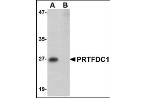 Western blot analysis of PRTFDC1 in human brain tissue lysate with this product at 1 μg/ml in the (A) absence and (B) presence of blocking peptide. (PRTFDC1 anticorps  (Center))
