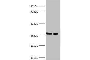 Western blot All lanes: HNRNPD antibody at 4 μg/mL Lane 1: Hela whole cell lysate Lane 2: 293T whole cell lysate Secondary Goat polyclonal to rabbit IgG at 1/10000 dilution Predicted band size: 39, 37, 33, 31 kDa Observed band size: 39 kDa (HNRNPD/AUF1 anticorps  (AA 1-306))