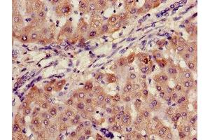 Immunohistochemistry of paraffin-embedded human liver tissue using ABIN7144667 at dilution of 1:100 (AADAC anticorps  (AA 24-399))