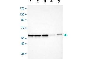 Western blot analysis of Lane 1: Human cell line RT-4; Lane 2: Human cell line U-251MG sp; Lane 3: Human cell line A-431; Lane 4: Human liver tissue; Lane 6: Human tonsil tissue with APEX1 polyclonal antibody  at 1:100-1:250 dilution. (APEX1 anticorps)