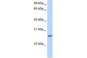ZNF664 antibody used at 0. (ZNF664 anticorps  (N-Term))