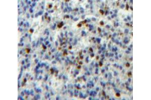 Used in DAB staining on fromalin fixed paraffin- embedded spleen tissue (ATG16L1 anticorps  (AA 1-284))