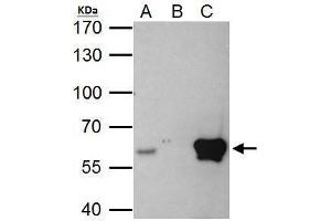 IP Image ETS2 antibody immunoprecipitates ETS2 protein in IP experiments. (ETS2 anticorps  (Center))
