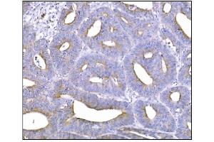 IHC analysis of NDEL1 using anti-NDEL1 antibody (ABIN7602511). (NDEL1 anticorps  (AA 80-320))