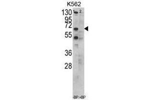 Image no. 1 for anti-Chaperonin Containing TCP1, Subunit 3 (Gamma) (CCT3) (C-Term) antibody (ABIN452830) (CCT3 anticorps  (C-Term))