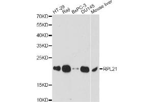 Western blot analysis of extracts of various cell lines, using RPL21 antibody. (RPL21 anticorps)