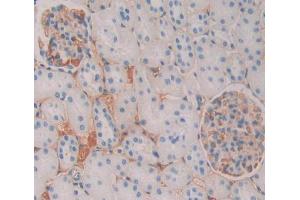Used in DAB staining on fromalin fixed paraffin- embedded kidney tissue