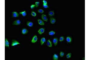 Immunofluorescent analysis of A549 cells using ABIN7164854 at dilution of 1:100 and Alexa Fluor 488-congugated AffiniPure Goat Anti-Rabbit IgG(H+L)