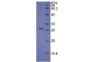 SDS-PAGE of Protein Standard from the Kit  (Highly purified E. (COL1A1 Kit ELISA)