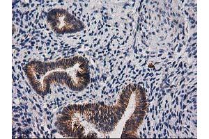 Image no. 7 for anti-Catenin (Cadherin-Associated Protein), beta 1, 88kDa (CTNNB1) antibody (ABIN1496894)