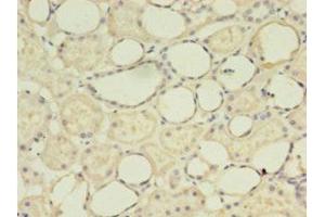 IHC analysis of paraffin-embedded human kidney tissue, using G0S2 antibody (1/100 dilution).