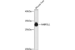 Western blot analysis of extracts of Mouse liver, using N4BP2L1 antibody (ABIN7268840) at 1:1000 dilution.