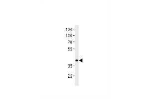 DANRE hoxd11a Antibody (Center) Azb10017a western blot analysis in zebra fish heart tissue lysates (35 μg/lane).