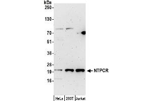 Western Blotting (WB) image for anti-Nucleoside-Triphosphatase, Cancer-Related (NTPCR) (AA 1-50) antibody (ABIN7449197)