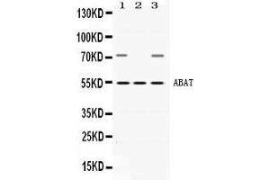 Western blot analysis of ABAT expression in rat brain extract ( Lane 1), mouse testis extract ( Lane 2) and HEPG2 whole cell lysates ( Lane 3). (ABAT anticorps  (AA 388-500))
