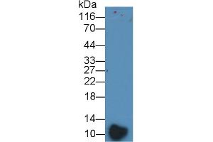 Detection of PF4 in Human Platelet lysate using Polyclonal Antibody to Platelet Factor 4 (PF4)