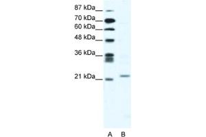 Western Blotting (WB) image for anti-Twist Homolog 1 (Drosophila) (TWIST1) antibody (ABIN2461623) (TWIST1 anticorps)