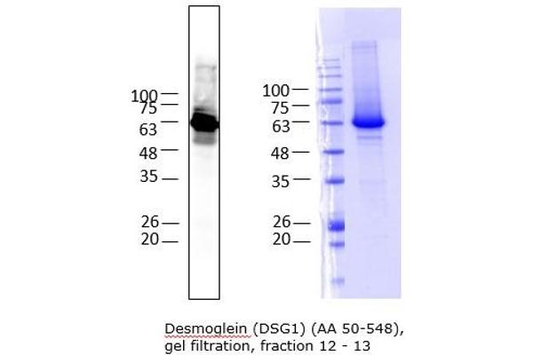 Desmoglein 1 Protein (DSG1) (AA 50-548) (His tag)