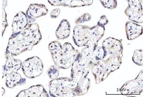 IHC analysis of RBM22 using anti-RBM22 antibody (ABIN7600268). (RBM22 anticorps  (AA 17-406))