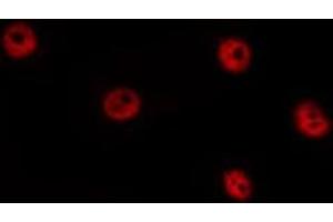 ABIN6277434 staining HepG2 by IF/ICC. (TCF7 anticorps)