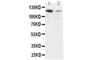 Anti-Integrin alpha 3 antibody, Western blotting Lane 1: Rat Heart Tissue Lysate Lane 2: HELA Cell Lysate (ITGA3 anticorps  (N-Term))