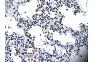 Rabbit Anti-ILF2 Antibody       Paraffin Embedded Tissue:  Human cardiac cell   Cellular Data:  Epithelial cells of renal tubule  Antibody Concentration:   4. (ILF2 anticorps  (C-Term))