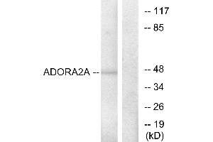 Immunohistochemistry analysis of paraffin-embedded human brain tissue using ADORA2A antibody. (Adenosine A2a Receptor anticorps  (Internal Region))