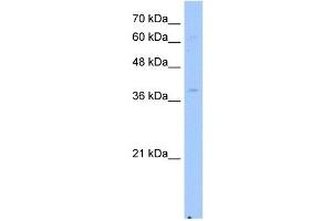 NSDHL antibody used at 2. (NSDHL anticorps)