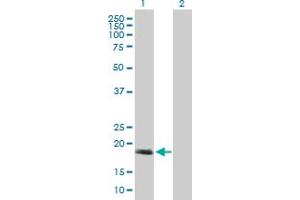 Western Blot analysis of C17orf49 expression in transfected 293T cell line by C17orf49 MaxPab polyclonal antibody. (C17orf49 anticorps  (AA 1-172))