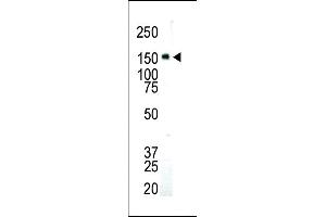 Western blot analysis of anti-IGF1R Pab (ABIN6242851 and ABIN6579005) in SK-BR-3 cell lysate.