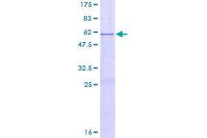 Hyaluronidase-1 (HYAL1) (AA 1-253) protein (GST tag)