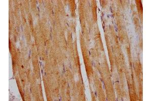 IHC image of ABIN7150742 diluted at 1:400 and staining in paraffin-embedded human skeletal muscle tissue performed on a Leica BondTM system. (DUSP13 anticorps  (AA 1-198))