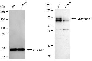 Western blotting analysis using Calsyntenin 1 antibody (ABIN7797854).