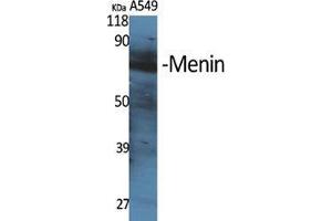 Western Blot (WB) analysis of specific cells using Menin Polyclonal Antibody. (Menin anticorps  (Internal Region))