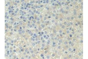 IHC-P analysis of Rat Adrenal gland Tissue, with DAB staining. (PPOX anticorps  (AA 9-300))