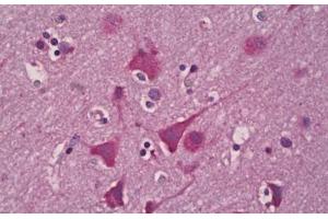 Anti-EPHX2 antibody IHC staining of human brain, cortex neurons.