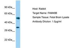 Image no. 1 for anti-Family with Sequence Similarity 49, Member B (FAM49B) (AA 22-71) antibody (ABIN6750181) (FAM49B anticorps  (AA 22-71))