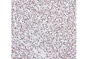 IHC analysis of NRF1 using anti-NRF1 antibody (ABIN7600874).