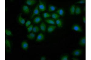 Immunofluorescence staining of A549 cells with ABIN7155179 at 1:200, counter-stained with DAPI. (PDE9A anticorps  (AA 426-533))