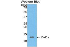 Western Blotting (WB) image for anti-Interleukin 8 (IL8) (AA 23-101) antibody (ABIN3201290) (IL-8 anticorps  (AA 23-101))