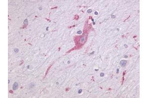 Anti-LPHN1 antibody IHC of human brain, neurons and glia. (Latrophilin 1 anticorps  (N-Term))