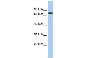 WB Suggested Anti-SNRK Antibody Titration: 0. (SNRK anticorps  (Middle Region))